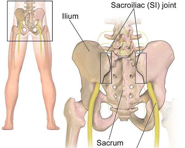 SI Joint Pain & Fusions