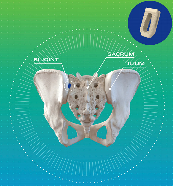 What Is The Treatment For Sacroiliac Joint Pain, Pain Management  Specialists & Anesthesiologists located in Greenbelt, MD